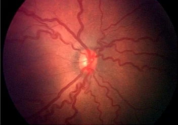Retina image